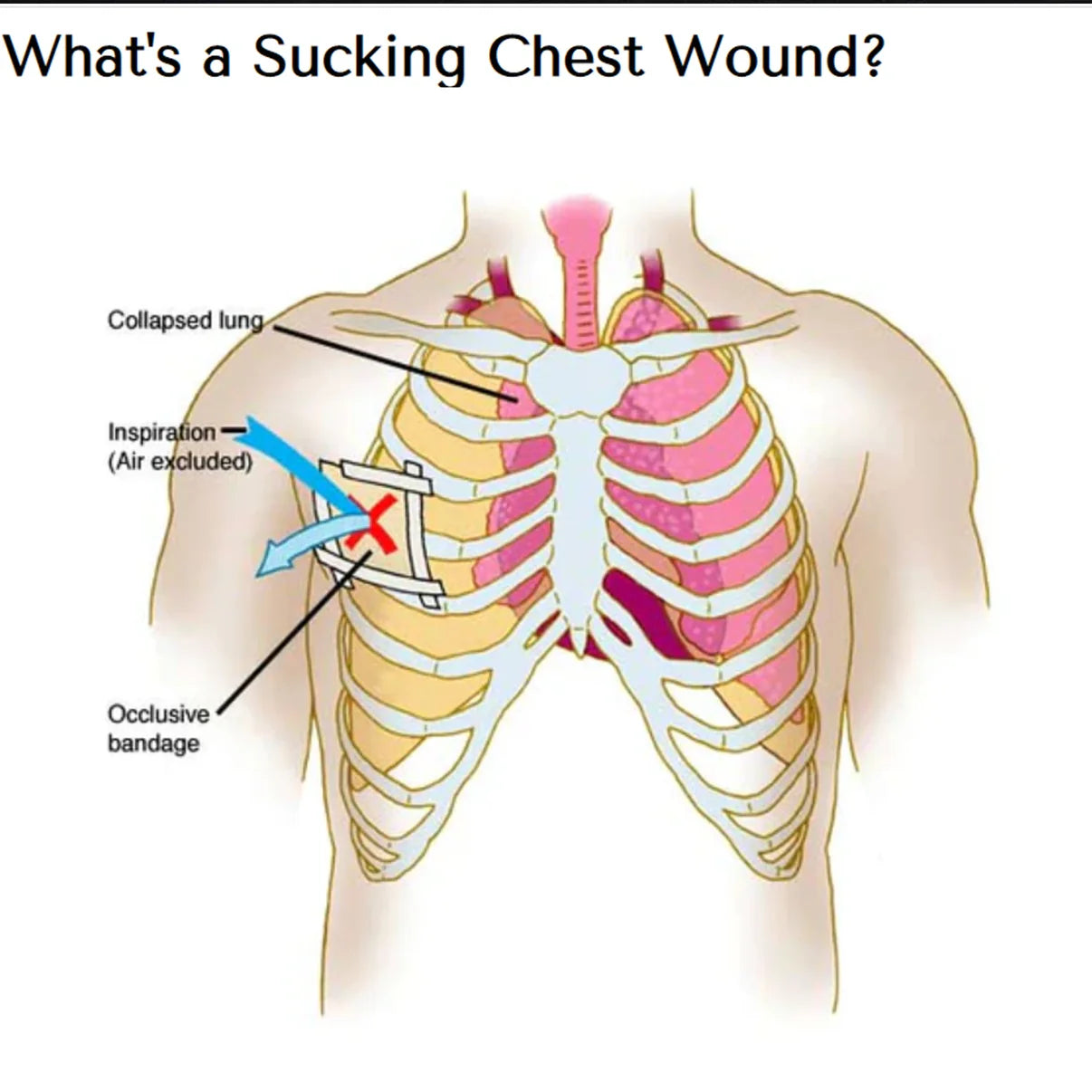 Chest Seal (2 pcs)