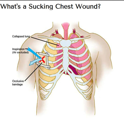 Chest Seal (2 pcs)